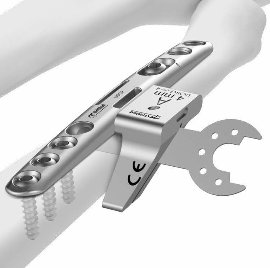 Ulna Compression Plate · Verkortings­osteotomie